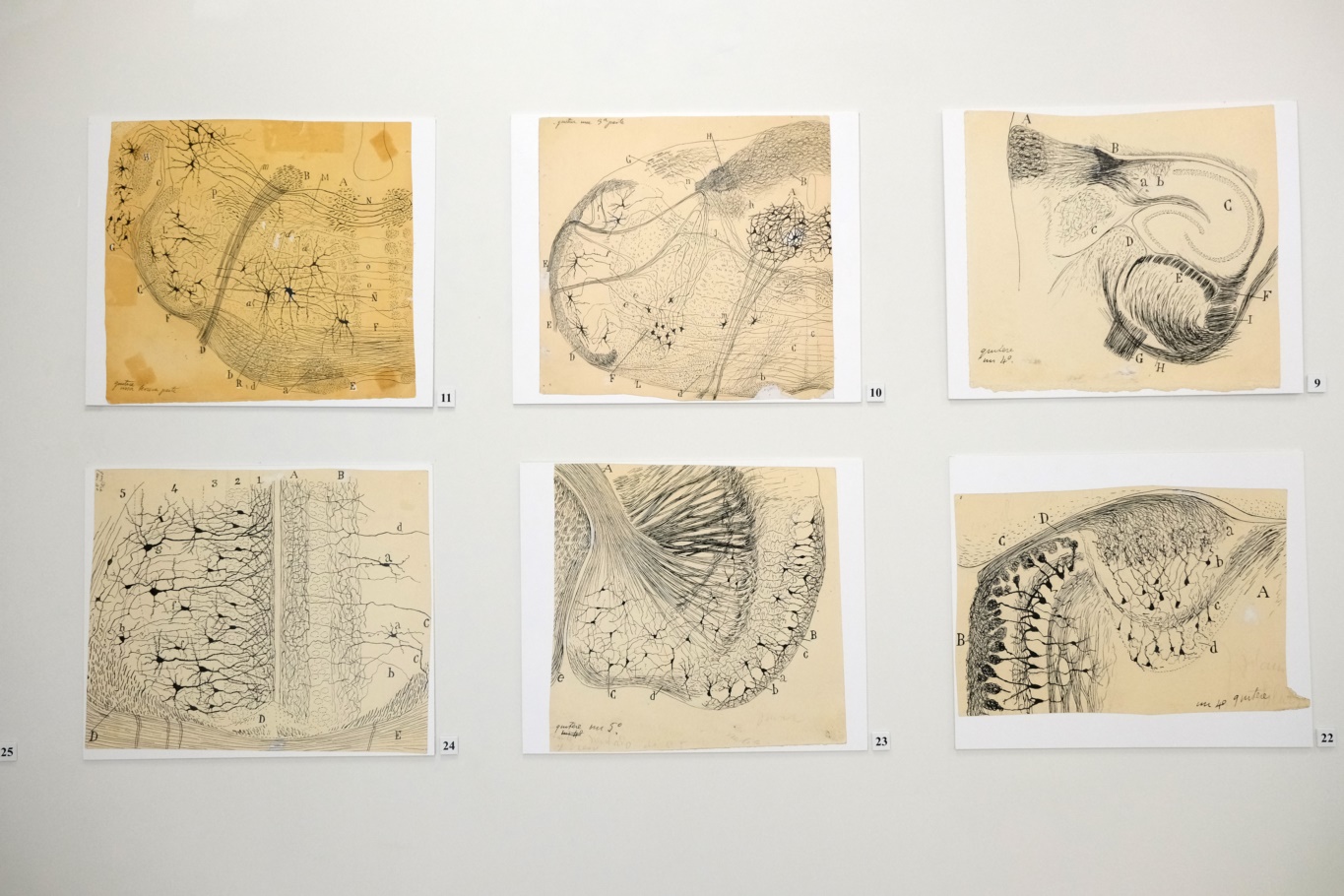 Migrenin kökeni aydınlanıyor: NÖROM’dan bağırsak–beyin eksenini gösteren çarpıcı bulgular;