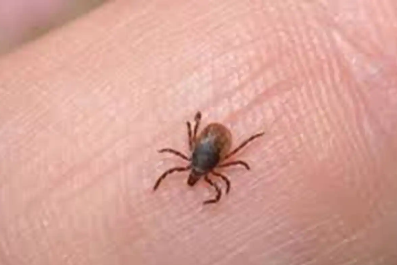 Havalar ısınıyor, kene vakalarına karşı nelere dikkat edilmeli