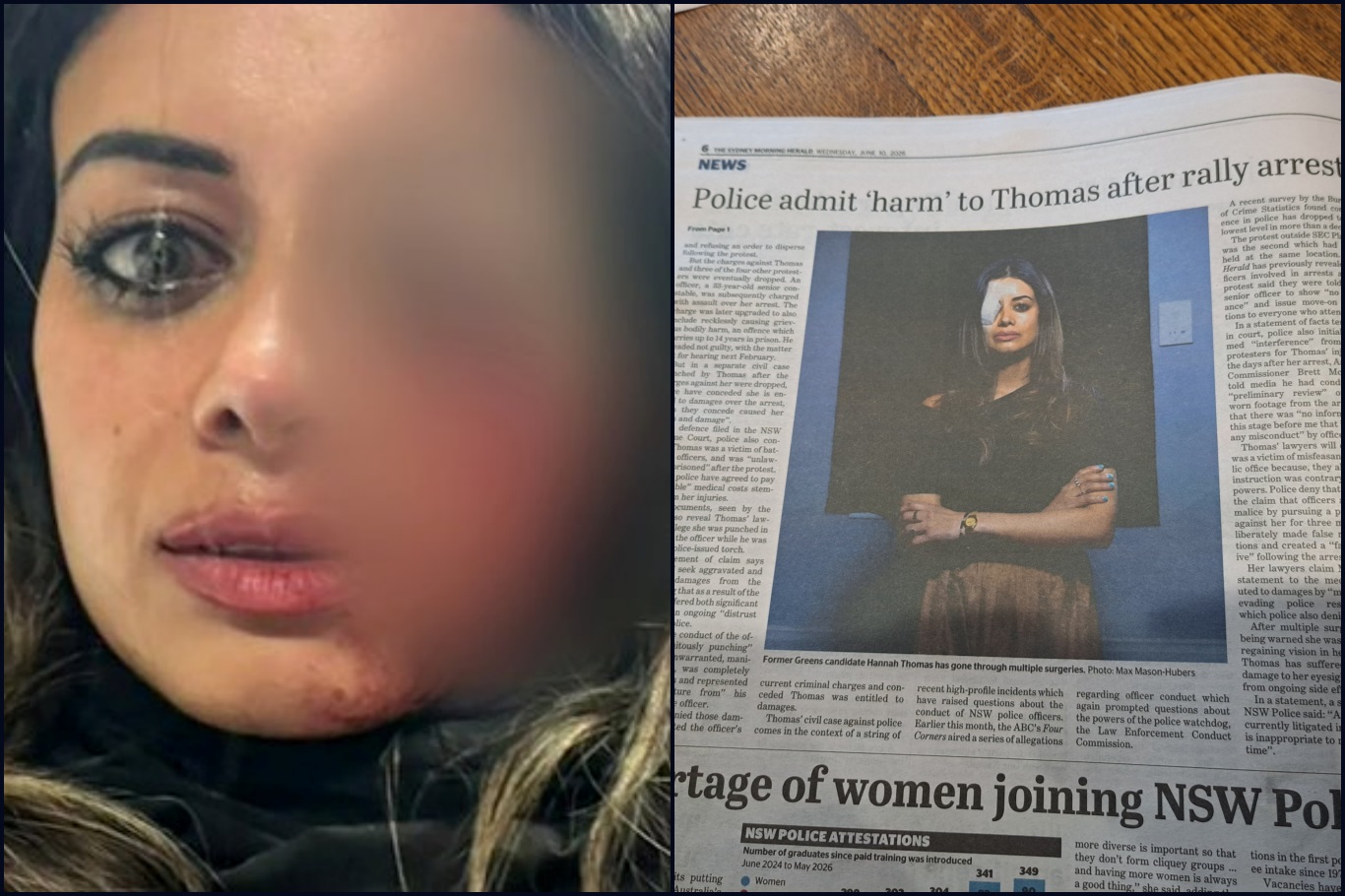 NSW hükümeti mahkemede kabul etti: Filistin destekçisi Hannah Thomas polis şiddetinin kurbanı oldu