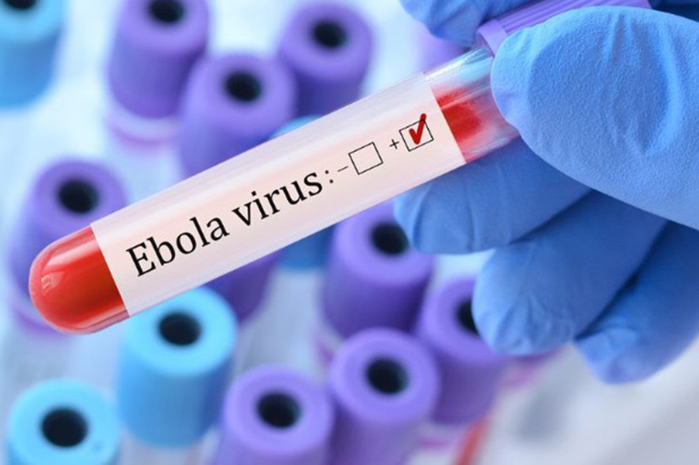 ABD'den Ebola önlemi: Kongo Demokratik Cumhuriyeti'nden dönüşlere geçici kısıtlama
