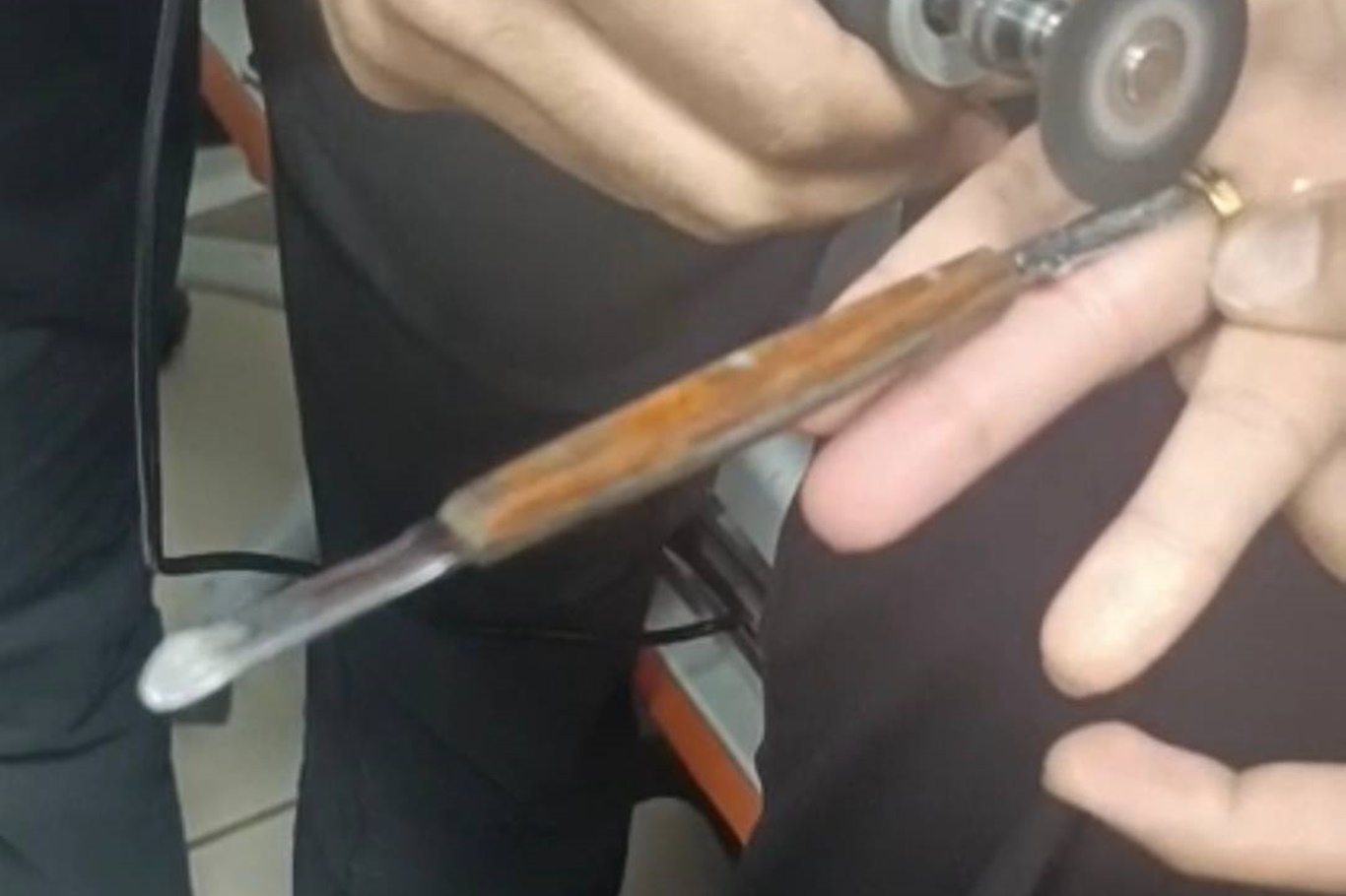 Batman'da parmağa sıkışan yüzük itfaiye ekiplerince kesildi