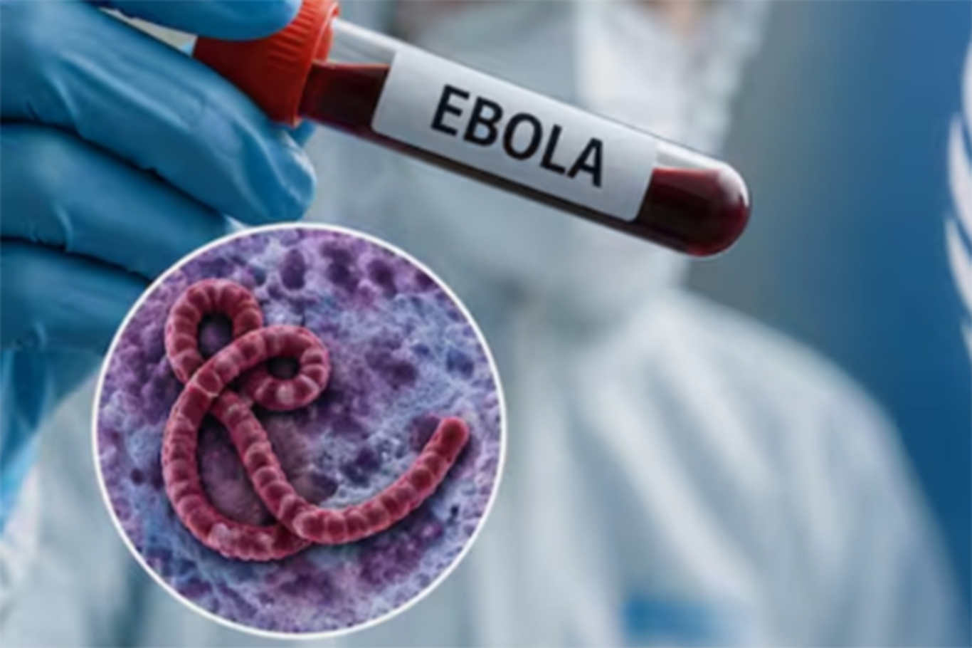 Kongo'da Ebola salgını: Ölü sayısı 1000'i aştı