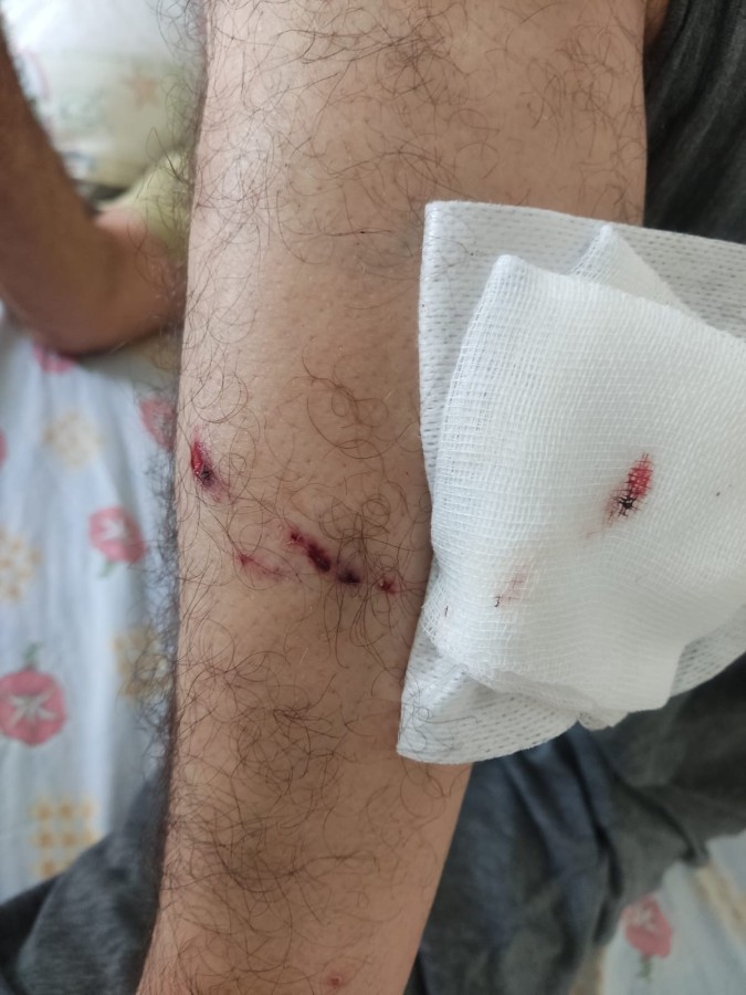 Şanlıurfa’da Sahipsiz Köpek Terörü: Sporcuları Parçalamaya Kalkıştılar;